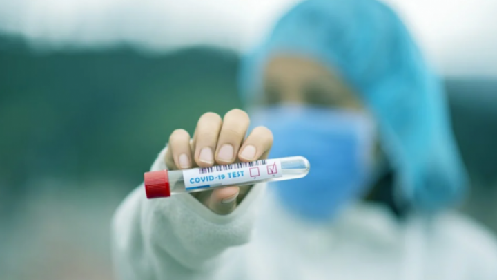 Naisa - srpski test na Kovid19