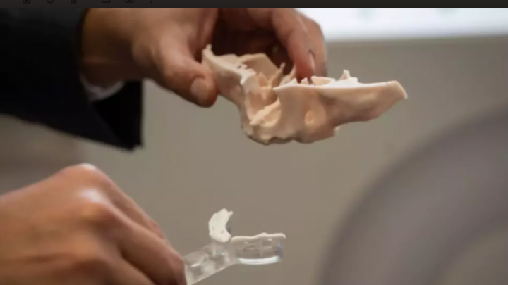 Revolucionarni keramički 3D štampani implant vilice